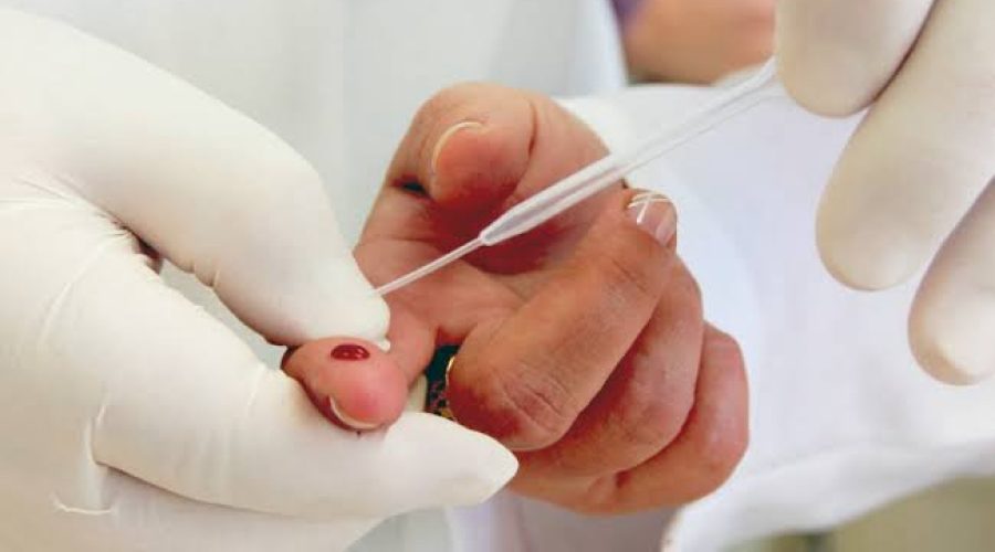 Jundiaí promove ações de conscientização na luta contra a Aids